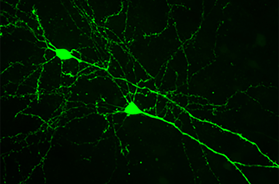 UC Neuroscience Graduate Program (@ucneurosci) on Twitter photo Are you an underrepresented undergrad interested in a neuroscience career?
Join us at "Neuro-Horizons", our summer 3-day workshop for populations underrepresented in science hosted by U of Cincinnati.
med.uc.edu/education/neur…
<a href="/BlackInNeuro/">Black In Neuro 🧠</a> <a href="/ABRCMS/">ABRCMS</a> @sacnas <a href="/GradCollegeUC/">The Graduate College at University of Cincinnati</a> Are you an underrepresented undergrad interested in a neuroscience career?
Join us at "Neuro-Horizons", our summer 3-day workshop for populations underrepresented in science hosted by U of Cincinnati.
med.uc.edu/education/neur…
<a href="/BlackInNeuro/">Black In Neuro 🧠</a> <a href="/ABRCMS/">ABRCMS</a> @sacnas <a href="/GradCollegeUC/">The Graduate College at University of Cincinnati</a>