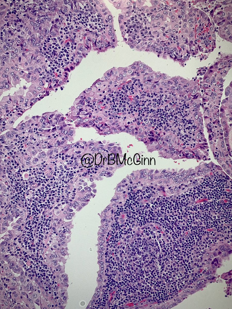 A very difficult case. One picture, what is going on? #Pathology