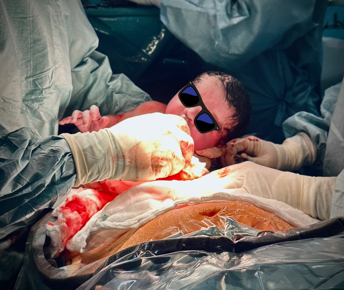 ernesto_teran's tweet image. Iniciamos el día con #AnestesiaObstétrica + cardiopatía materna.
😍😎