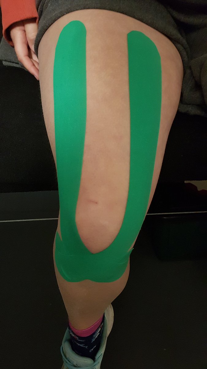 ctfitt's tweet image. Some of the K taping this week at CTFitness and Sports Therapy . Some of the benefits of kinesiology taping are to improve circulation, support muscles and help prevent injury or further injury.

ctfitness.co.uk/taping.html
#taping #ctfittst @SheptonG @FeelGoodBath @MSNNubNews