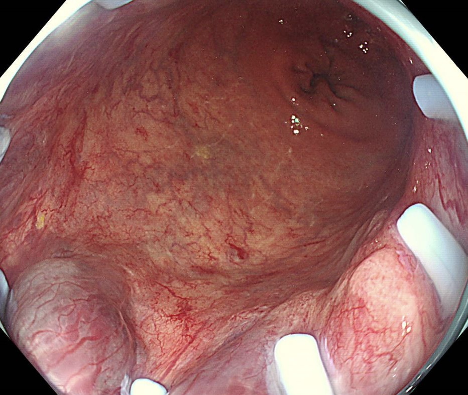 Keith Siau tweet media