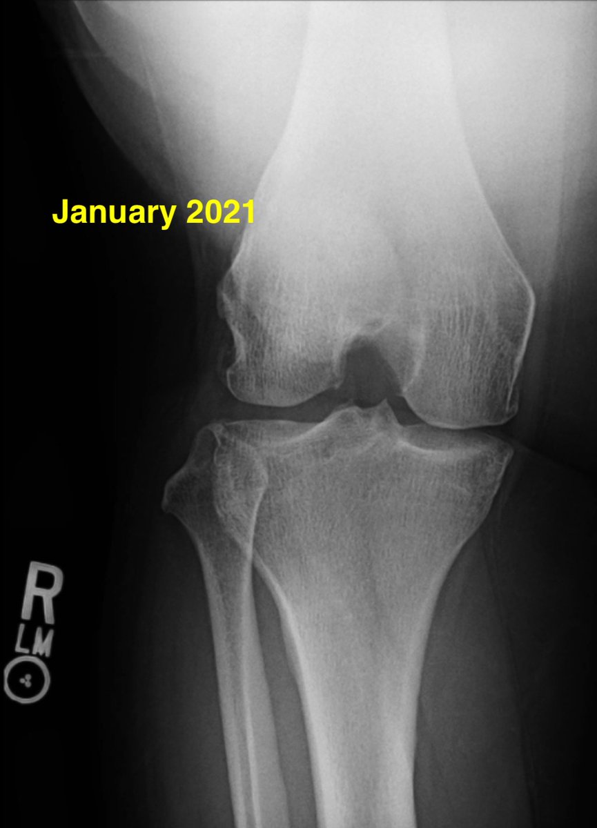 Daniel Liechti, MD tweet media