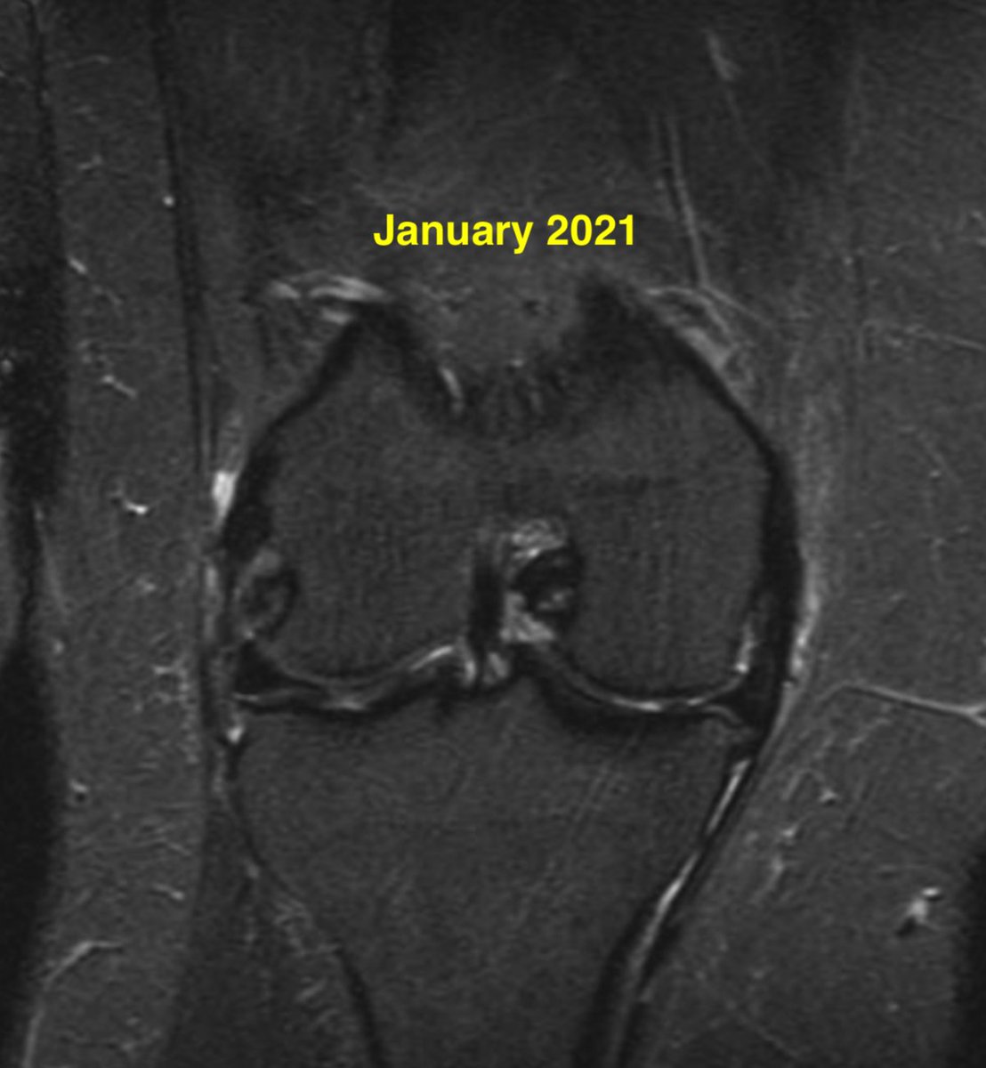 Daniel Liechti, MD tweet media