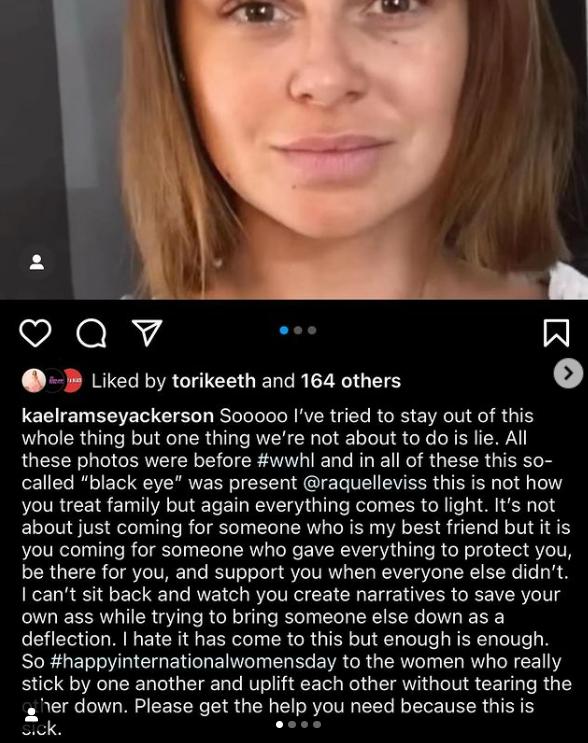BravoStanHan's tweet photo. unedited black eye photos! from BEFORE #WWHL?!?!
#Scandoval #PumpRules #Rachel #Raquel #Schenea https://t.co/ls4KSgNbP2
