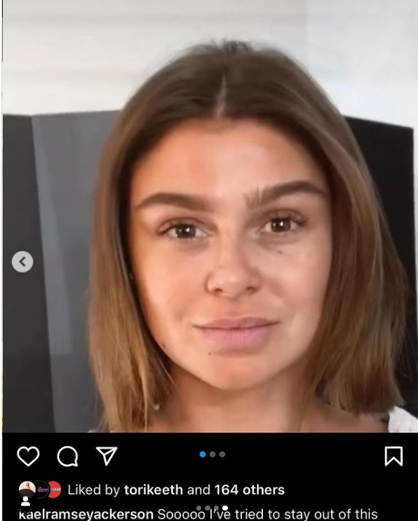 BravoStanHan's tweet photo. unedited black eye photos! from BEFORE #WWHL?!?!
#Scandoval #PumpRules #Rachel #Raquel #Schenea https://t.co/ls4KSgNbP2