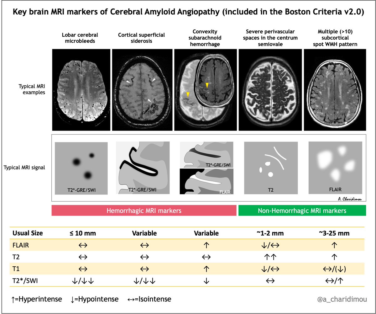 🧠🩸Cerebral amyloid angiopathy: Core MRI markers

(⚡️Updated)

#MedTwitter #MedStudentTwitter #MedEd #FOAMed
#neurotwitter #Neurology #stroke #Neurosurgery  #EndNeurophobia #FOAMrad #NeuroRad #neuroradiology #radiology #radres  #RadEd #FOAMncc #MRI