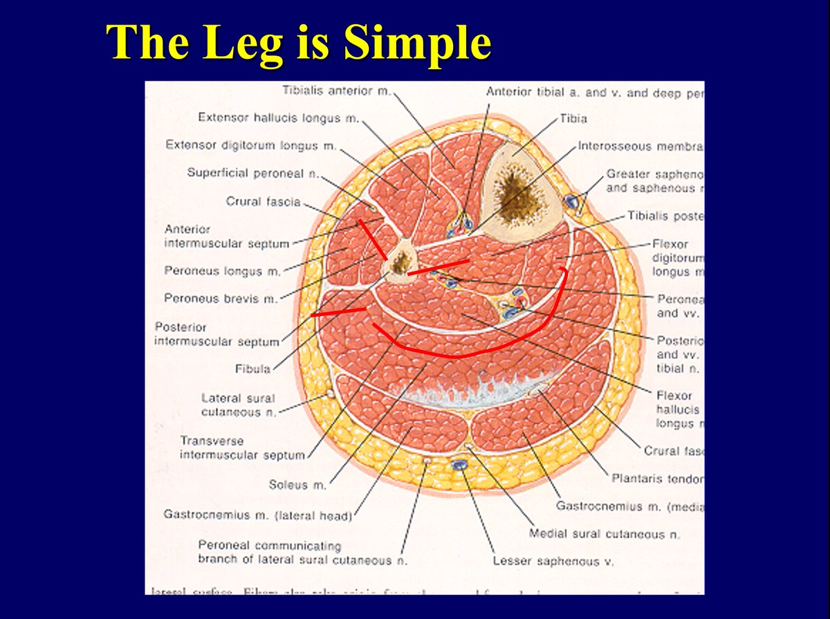 plumber145's tweet photo. the leg is simple https://t.co/eRROp5ekMA