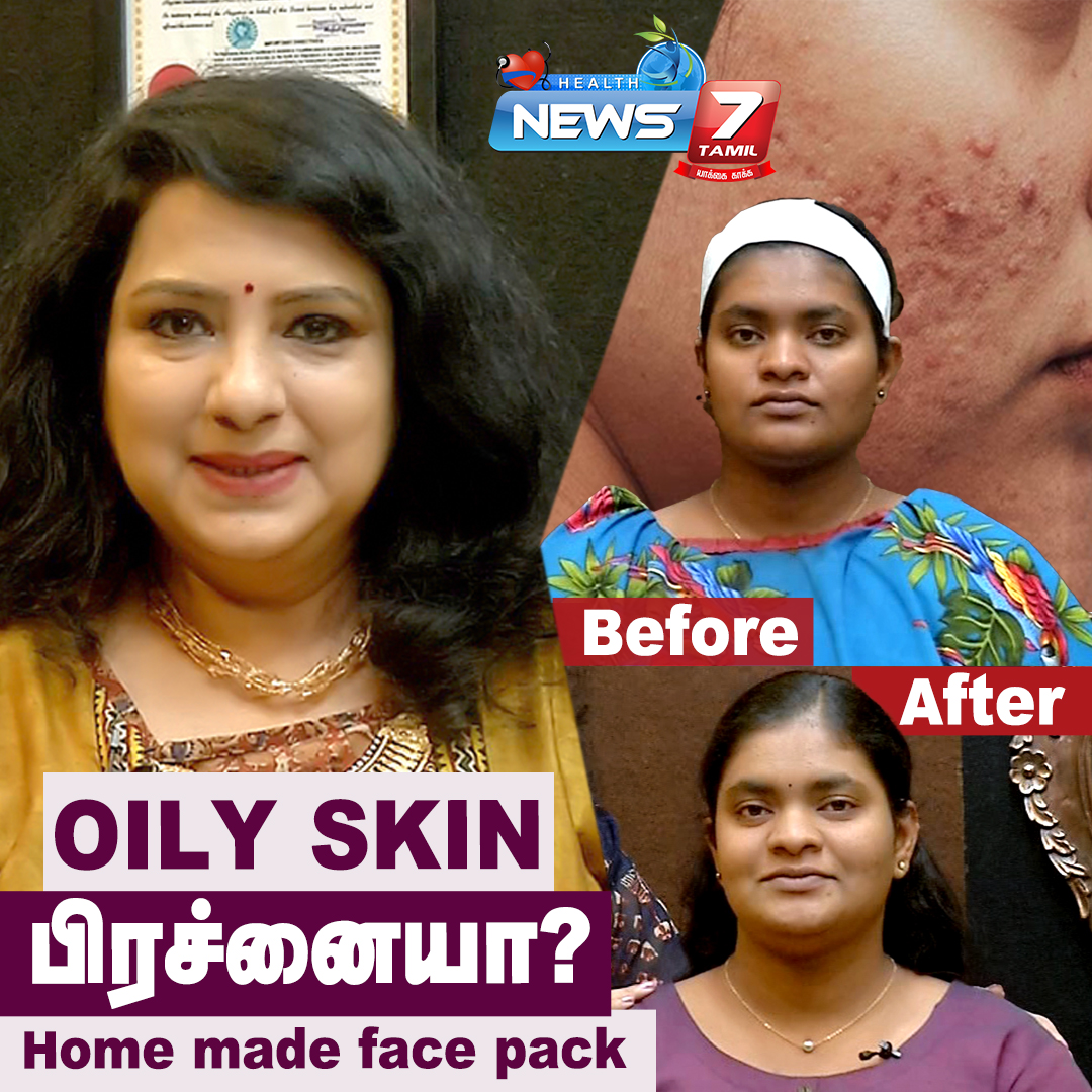 news7tamil's tweet image. Pimples நீக்கும் Herbal Home made Face Pack for Oily skin | Vasundra 

LINK: bit.ly/3l3blDa

#Oilyskin #Pimplesremoval #Vasundra #Pimplestreatment #Fcaepackforoilyskin #Herbalfacepackforoilyskin
#News7TamilHealth