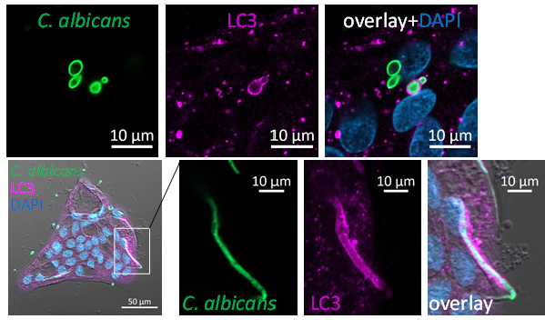 CohenKedar's tweet photo. 5/6 We show LC3-associated phagocytosis of C. albicans yeast and hyphea by human intestinal organoids, and their degradation in the lysosomes. https://t.co/W5Svzea4vc