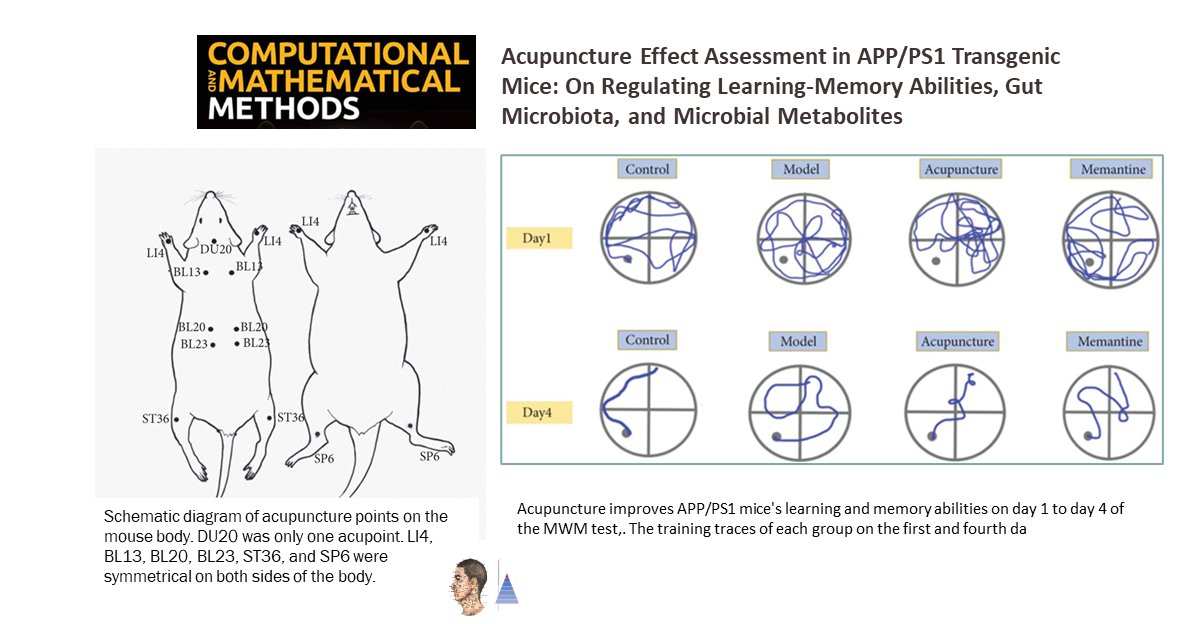 PreuvesAcup's tweet photo. 🐀Acupuncture expérimentale 🇨🇳
📰Comput Math Methods Med
Modèle d’#Alzheimer [souris]. L’acupuncture 𝑣𝑠 mémentine ↗mémoire et apprentissage [test de la piscine de Morris]. Action 𝑣𝑖𝑎 ↘protéines aβ et tau [hippocampe] et régulation du microbiote.

https://t.co/g5UfTtWvF3🔓 https://t.co/20j1Aulzkn