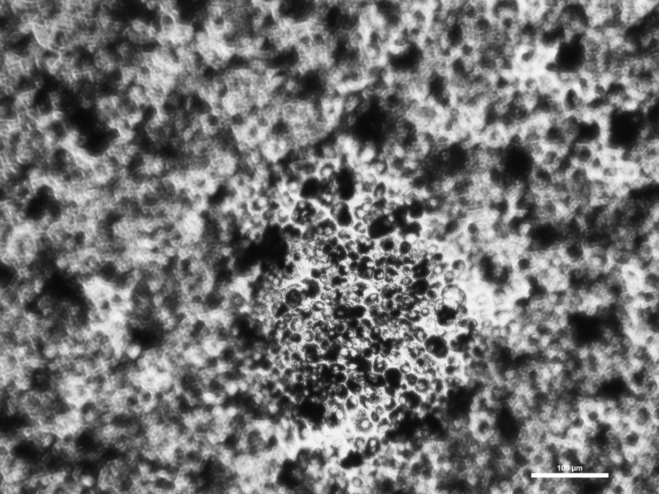 IOTW! PhD student Dillon Weatherston grew retinal epithelial cells on thicker #hagfish membranes. These cells formed raised domes (in focus) similar to the lipid deposits (drusen) seen in the early stages of #maculardegeneration.

#science #visionresearch #retina #eyesight
