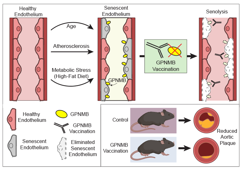 JCA_Journal's tweet photo. Dr. @TravisBLear and Dr. Toren Finkel commented on an article published in @NatureAging by Dr. Minamino et al., which suggested that a novel vaccine-based strategy might provide a targeted method to eliminate the #senescent #cell population. 
https://t.co/LkSIQtQAI2
#Senolytic https://t.co/oMCLExsx2f