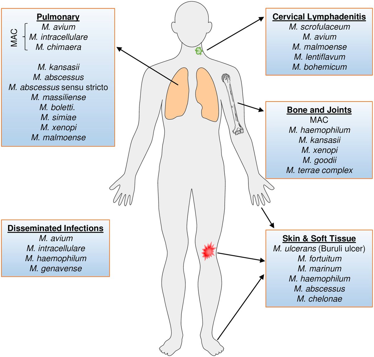 A 25yrold man IVDU 👉 one bout of Pneumocystis jiroveci pneumonia last