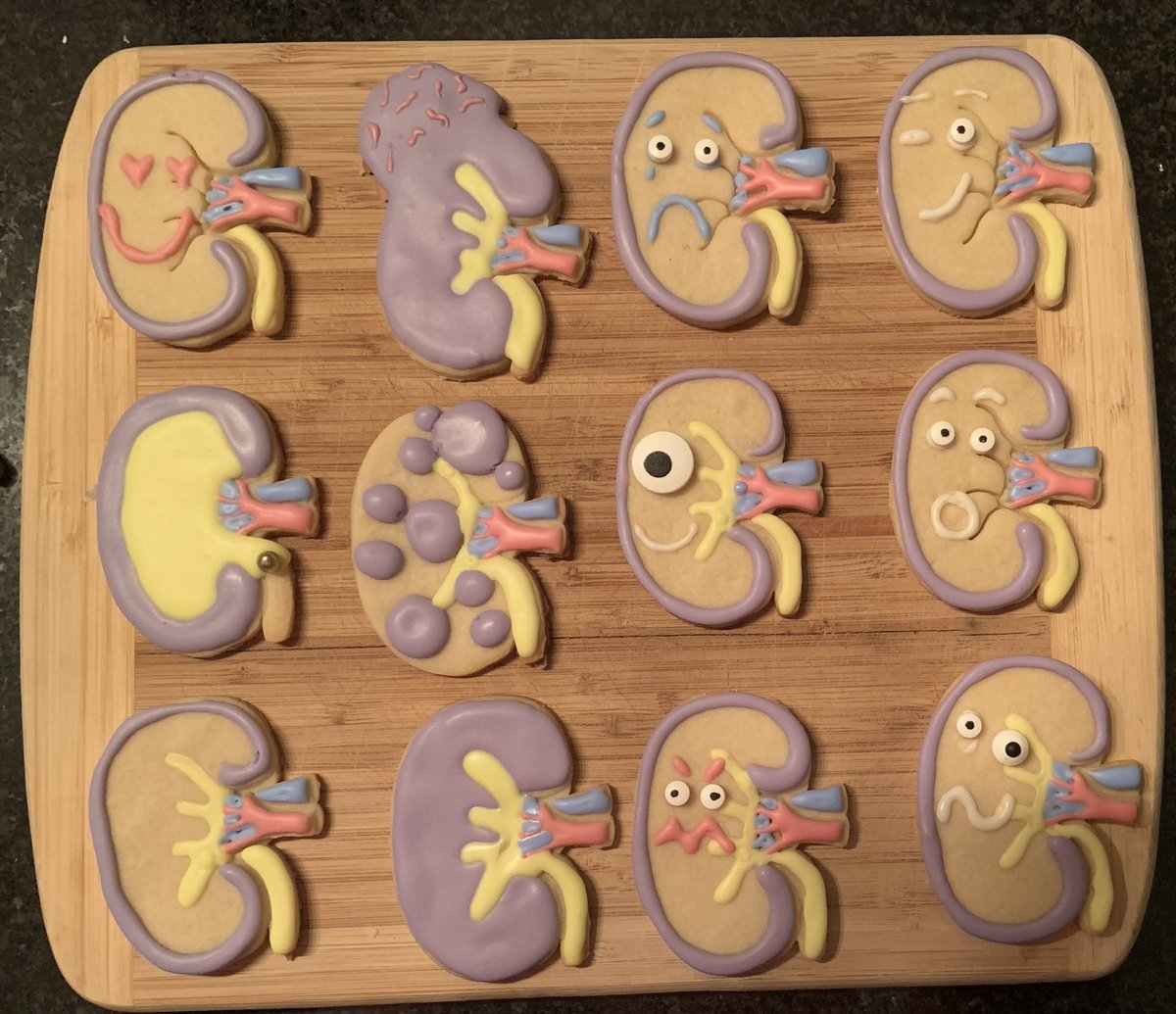 Happy world kidney day🫘🎉
This years addition—faces! There are many emotions experienced through the journey of kidney disease, attempted representation of just a few! Plus some of many kidney diseases (and healthy too!) #KidneyDay