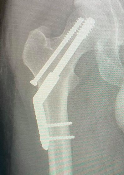 sopitas's tweet photo. ¡Ay no! Kevin Parker compartió hace unas horas que después de correr media maratón se fracturó la cadera. La buena noticia es que ya se está recuperando y además dijo que los conciertos en México y América del Sur se harán sí o sí. “No voy a renunciar a ustedes”. 🥹🙌
#TameImpala https://t.co/NsiXzvHXq9