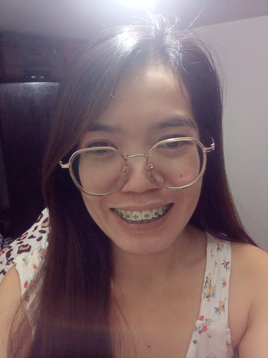 Rolieme22's tweet image. 89th day of braces 😁

#overbite