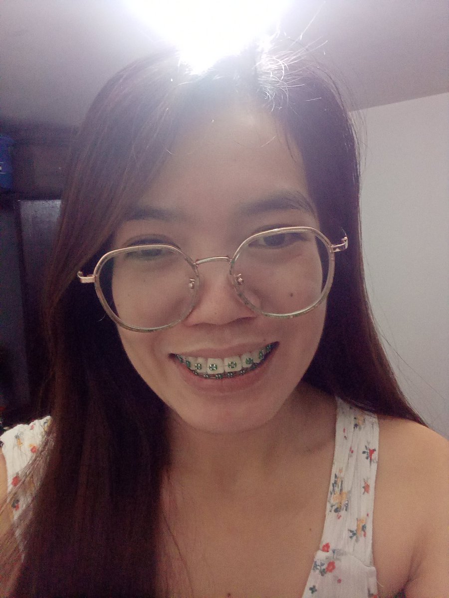 Rolieme22's tweet image. 89th day of braces 😁

#overbite