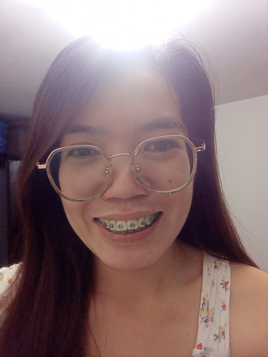 Rolieme22's tweet image. 89th day of braces 😁

#overbite