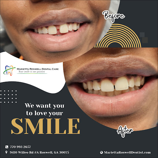 We want you to love your Smile :) Ready to start your smile makeover journey? Visit our website to schedule a consultation today. Let us help you reclaim your smile and boost your self-confidence. #laserdentistry #dentistry #cosmeticdentistry #dentalimplants #bygodreamz