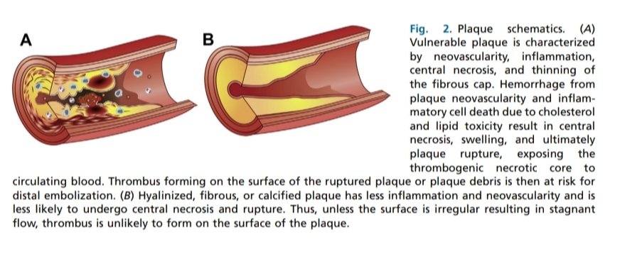 JMMR83's tweet photo. Ultrasonido carotídeo.
@NephroP @OswaldoRamosN @lameliav @DraSadhy @resonarte_8a @DraMariaSerna @DrSamyLo @drPowerDoppler @TaotePOCUS @trigeminy_henry @anaseguragrau @y_interna @yaletung @SonoSamMD @curromir @zbriote @ABCDEcografia @AnujAggarwal44 @ElhefnawiYara @EcosemfyC https://t.co/EAGqWFQiZb
