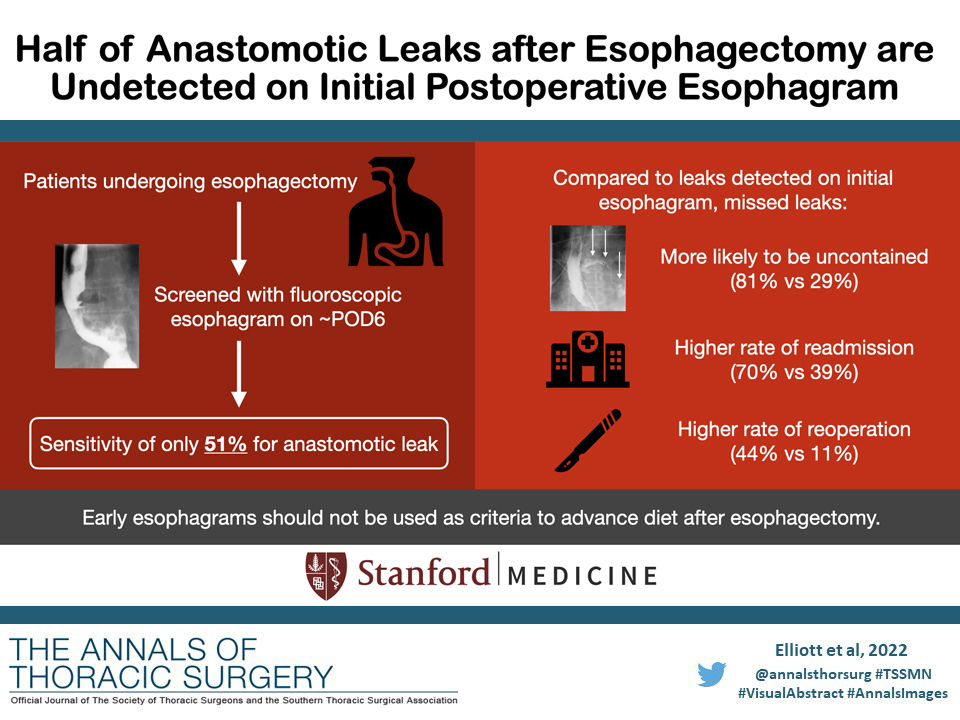 #VisualAbstract from 'Half of Anastomotic Leaks After Esophagectomy Are Undetected on Initial Postoperative Esophagram' by @irmelliott, Shrager, and coauthors: doi.org/10.1016/j.atho… #AnnalsImages @wltrope @natalielui22 @BAG_MD @leahbackhusmd