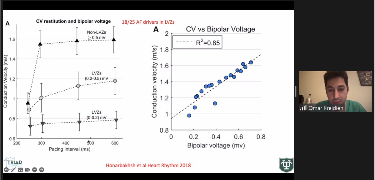 So great to see ⁦<a href="/OmarKreidieh1/">Omar Kreidieh</a>⁩ back this morning to teach us about atrial myopathies! ⁦<a href="/True_EP/">William H. Sauer, MD</a>⁩ ⁦<a href="/paulzei/">Paul Zei</a>⁩ ⁦<a href="/BrighamFellows/">Brigham & Women's CV Fellows</a>⁩ ⁦<a href="/Brigham_EP/">Brigham EP</a>⁩ ⁦<a href="/nmarrouche/">Nassir Marrouche</a>⁩ #EPeeps
