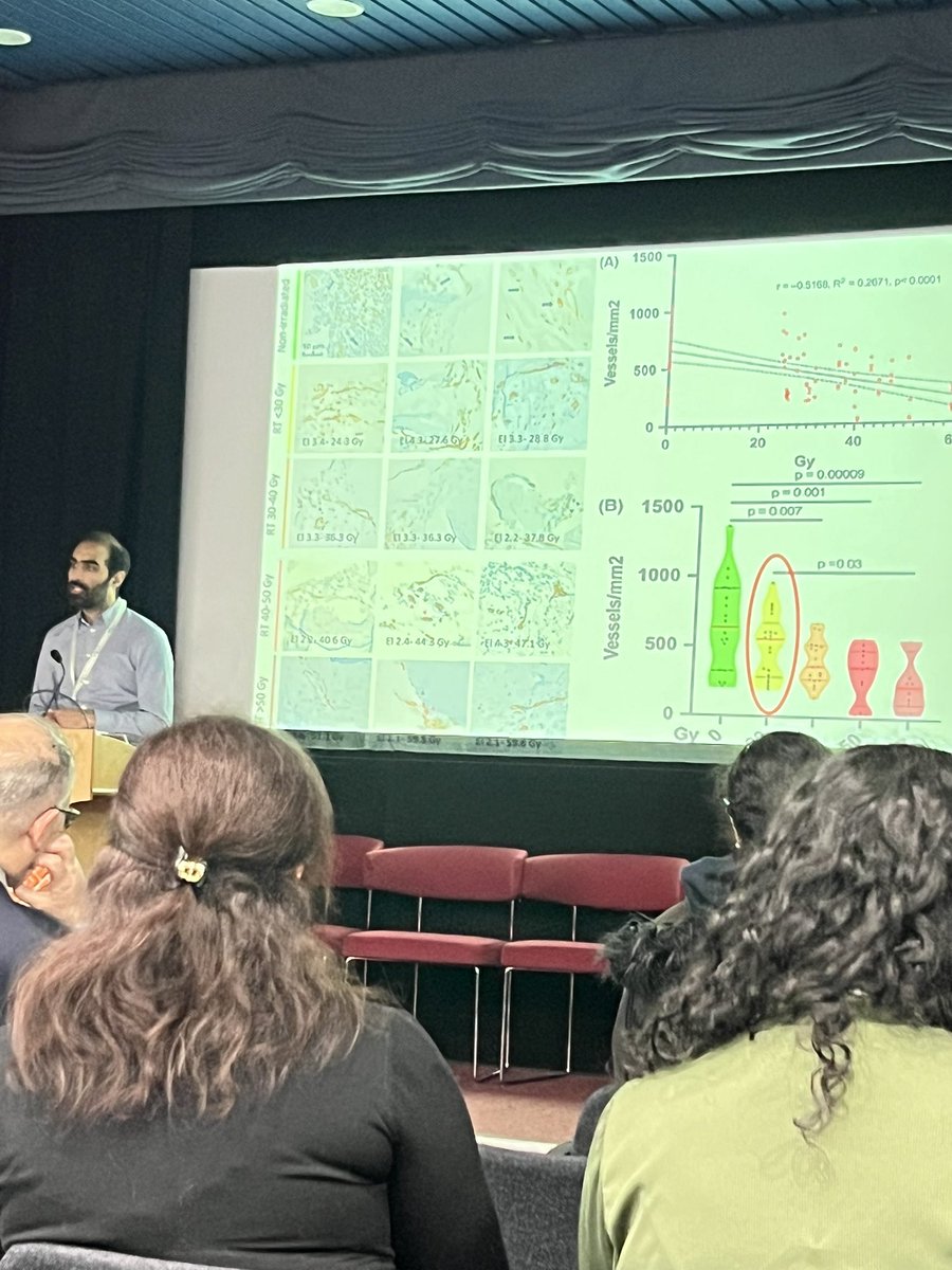 Fantastic talk by Dr. Vinod Patel, HPV+ patients with late radiation effects how to treat especially late radiation osteonecrosis and ameloblastoma that share same mutation as melanoma in BRAF &amp; MEK