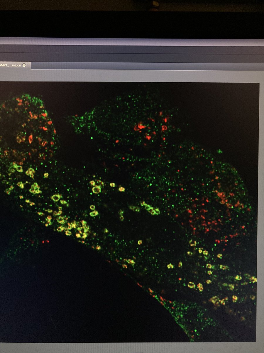 Looking for CMA-active #lysosomes co-stained with LAMP1 and LAMP2A. I do love airyscan super-res… ❤️