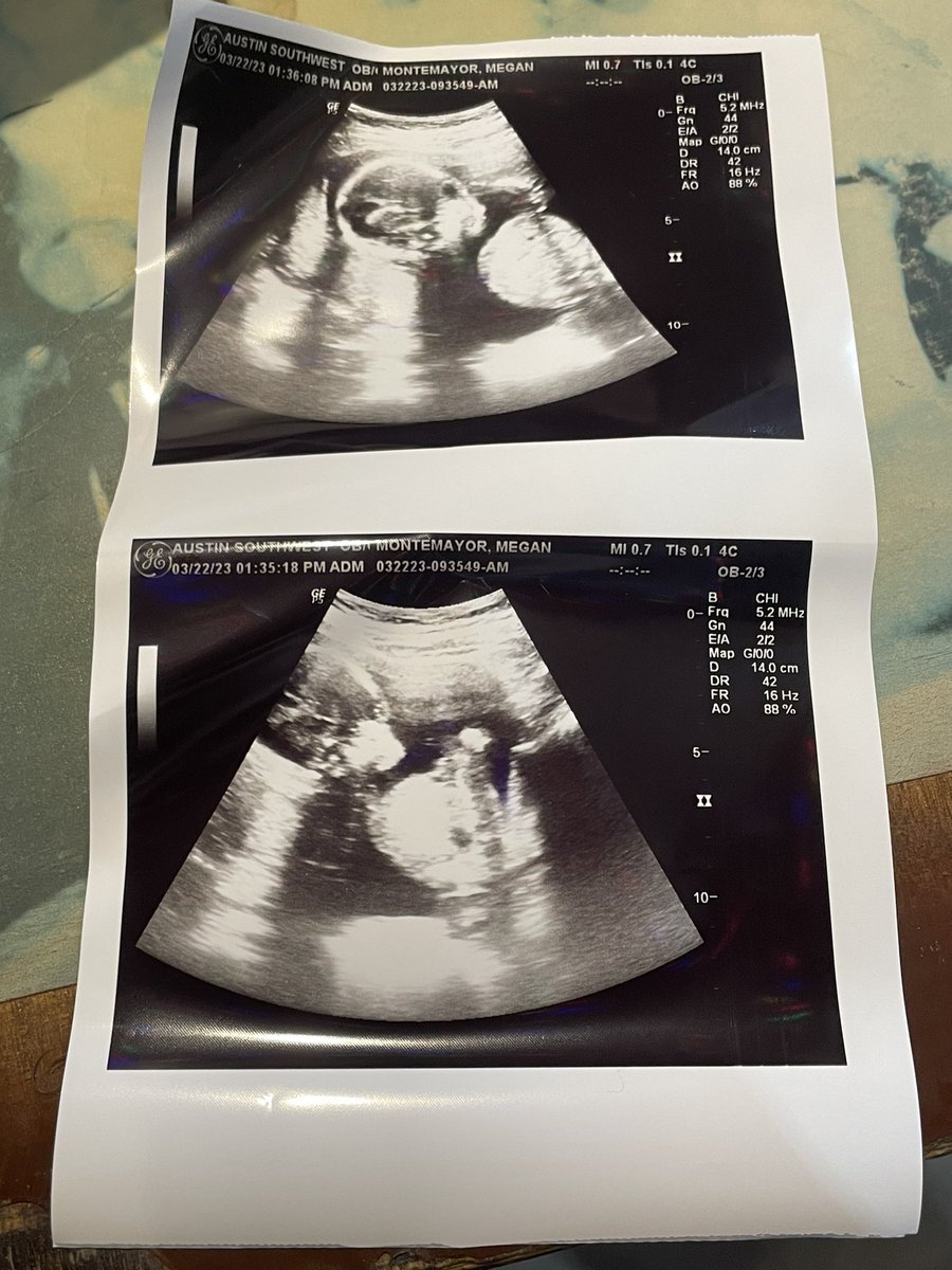 reido.base.eth 🍌🦍 tweet media