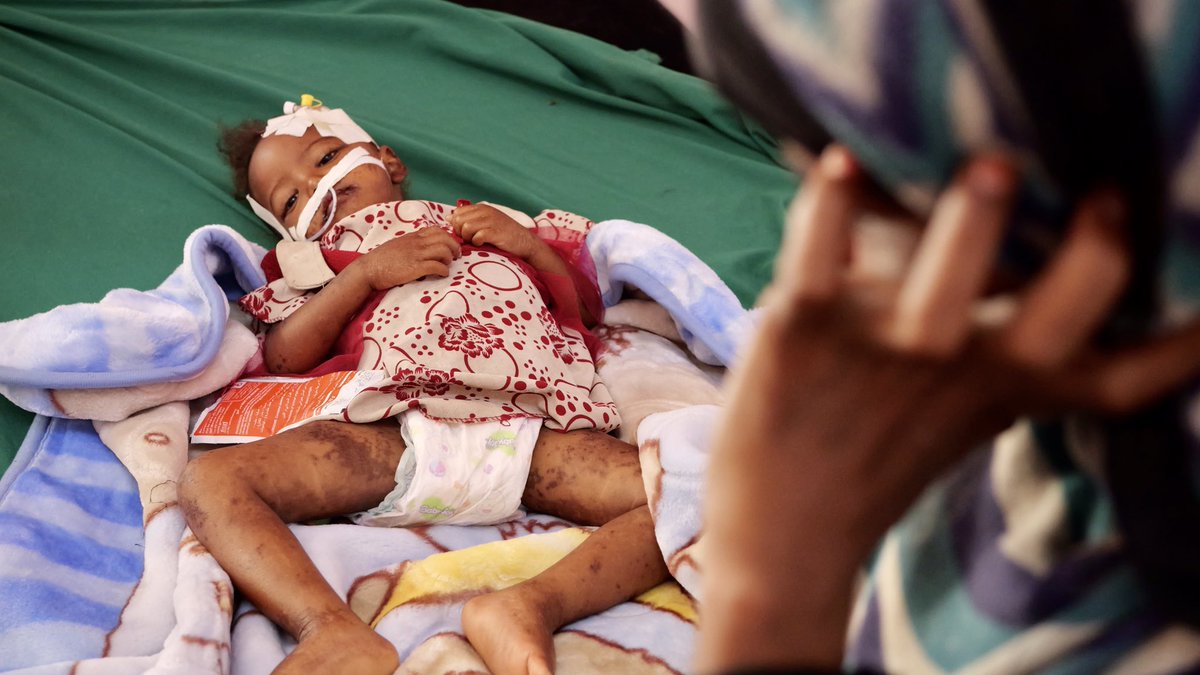 AlexCrawfordSky's tweet photo. Shocking scenes of children dying from hunger in Yemen : we’re the first foreign reporters INSIDE since the breakthrough between Saudi Arabia and Iran.. two countries fuelling this conflict. Watch our series of exclusive reports on @skynews ⁦@skyzein⁩ ⁦@ahmedbaider1⁩ https://t.co/TaadYDN9dZ