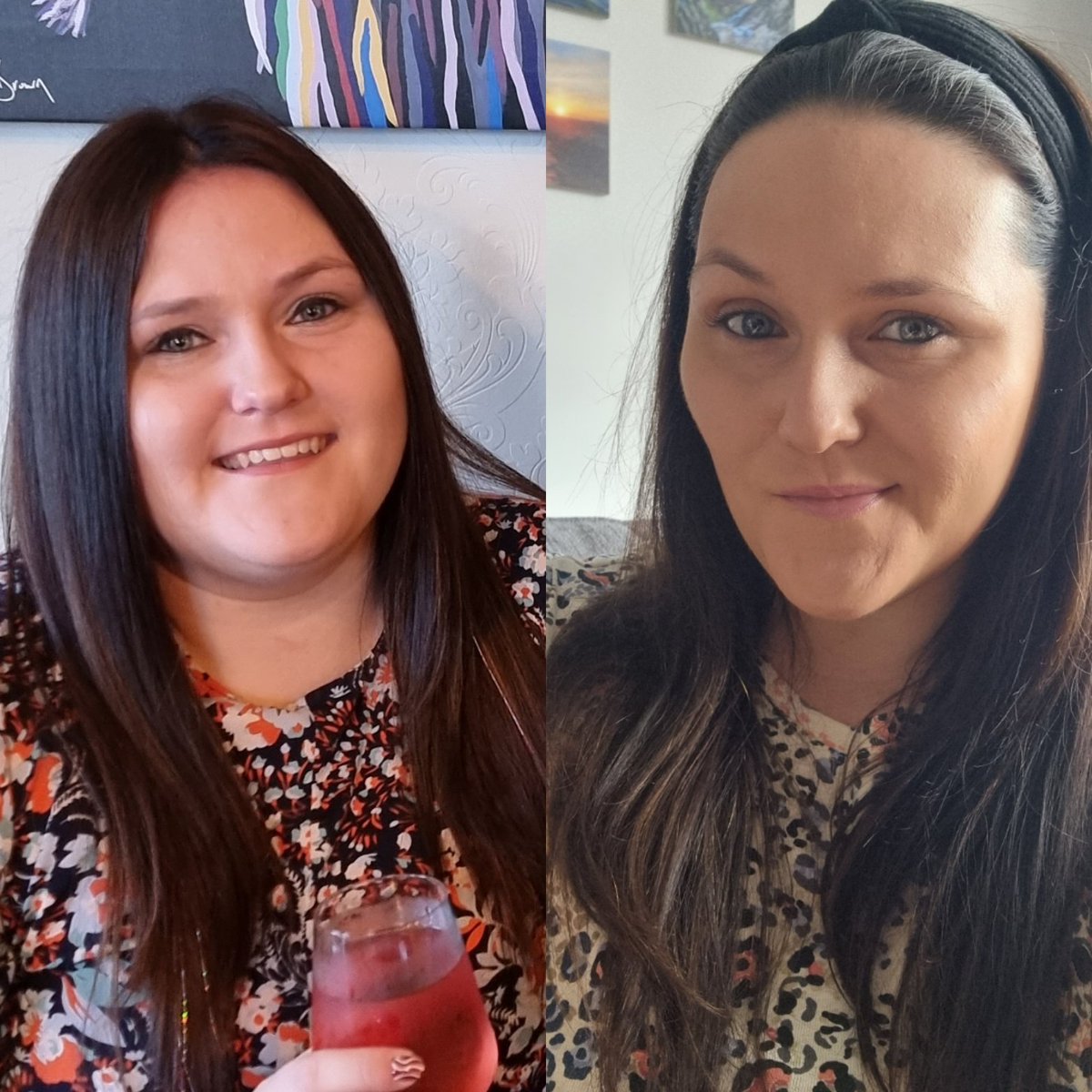 SophiLouBar's tweet photo. Face to Face Friday π
Hello cheeks π
#F2FFriday #FaceToFaceFriday #12WeekProgress https://t.co/RGK5xqCVcP