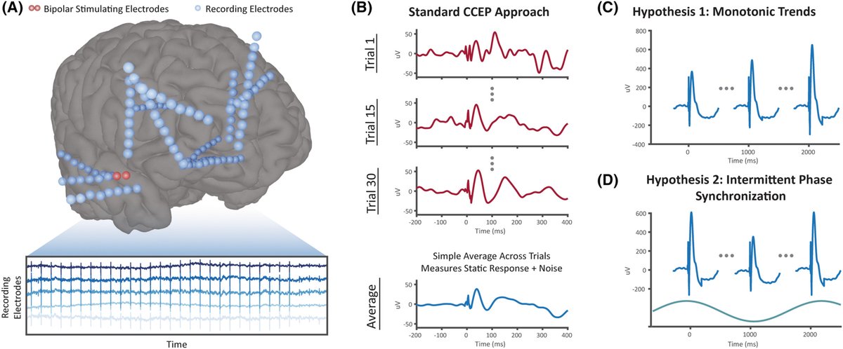 Penn Medicine CSO (@pennmedcso) on Twitter photo #CCEP mapping variability🧠 ft. <a href="/EliCornblath/">Eli Cornblath</a>, <a href="/alfrelucs/">Alfredo Lucas</a>, Adam Greenblatt, <a href="/PeterNHadar/">Peter N. Hadar, MD, MS</a>, Ramya Raghupathi, Eric Marsh, <a href="/BrianLitt2/">Brian Litt</a>, @katedavis12341, Erin Conrad (<a href="/PennNeurology/">University of Pennsylvania Neurology</a>), Caren Armstrong (<a href="/CHOP_Research/">CHOP Research</a>) & <a href="/joelsteinmd/">Joel M. Stein</a> (<a href="/PennRadiology/">Penn Radiology</a>) bit.ly/3yM7mhf #CCEP mapping variability🧠 ft. <a href="/EliCornblath/">Eli Cornblath</a>, <a href="/alfrelucs/">Alfredo Lucas</a>, Adam Greenblatt, <a href="/PeterNHadar/">Peter N. Hadar, MD, MS</a>, Ramya Raghupathi, Eric Marsh, <a href="/BrianLitt2/">Brian Litt</a>, @katedavis12341, Erin Conrad (<a href="/PennNeurology/">University of Pennsylvania Neurology</a>), Caren Armstrong (<a href="/CHOP_Research/">CHOP Research</a>) & <a href="/joelsteinmd/">Joel M. Stein</a> (<a href="/PennRadiology/">Penn Radiology</a>) bit.ly/3yM7mhf
