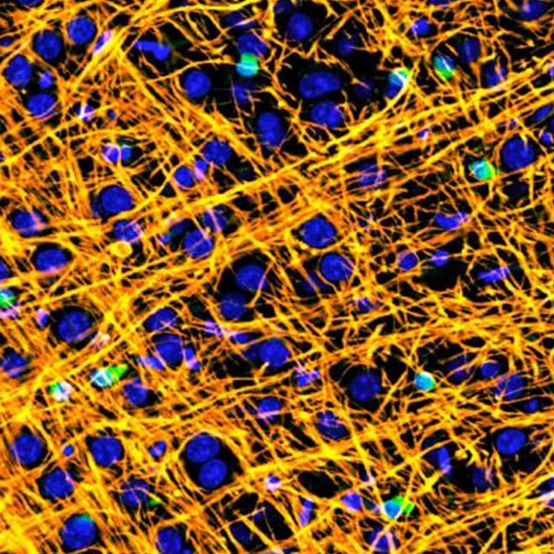 mssocietyuk's tweet photo. This week we've been sharing exciting clinical trials taking us closer to stopping MS.
Swipe to see an overview of the amazing #MSResarch happening right now. πβοΈ
#StopMS