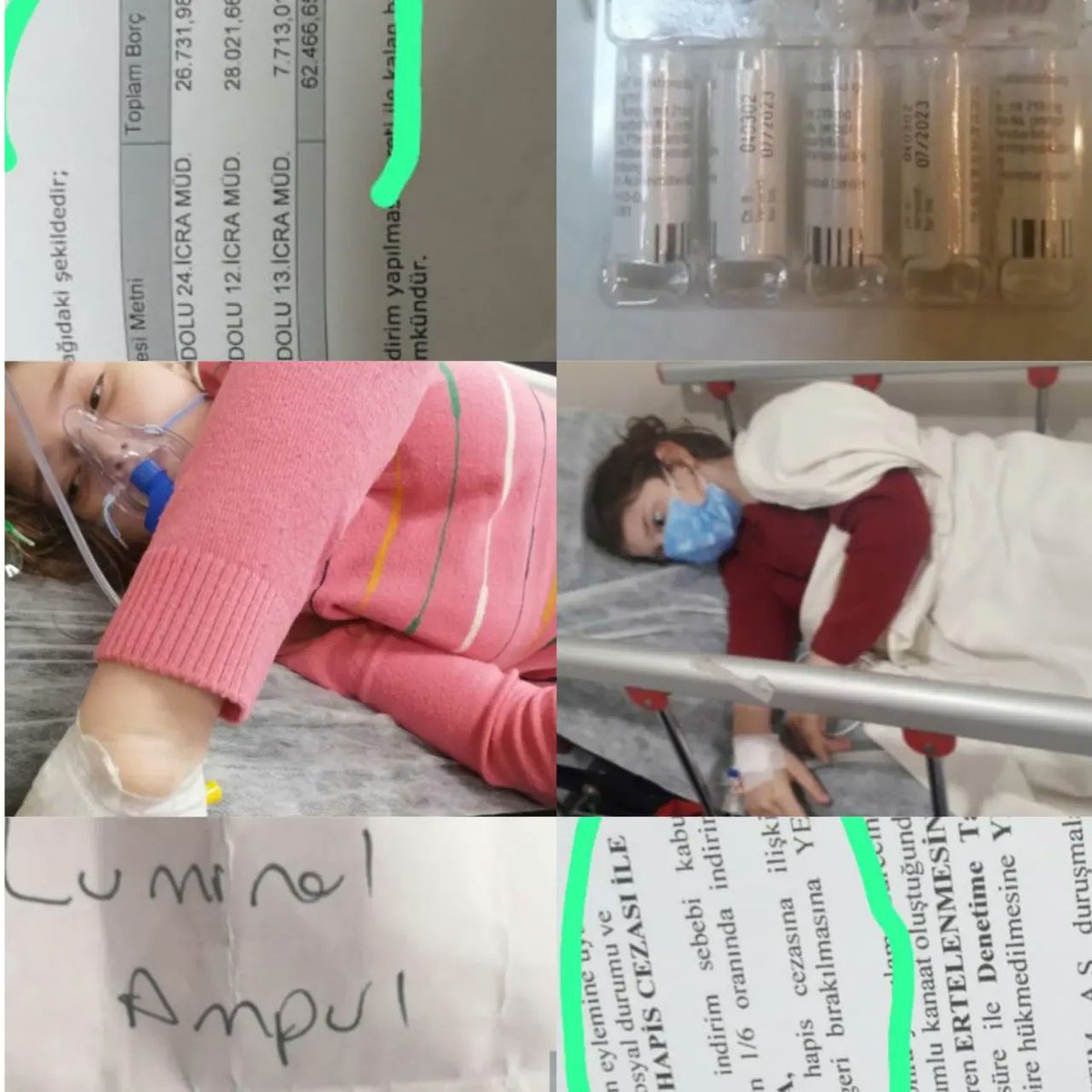 sibel_yucel's tweet photo. Melek HİDROSEFALİ HASTASI,BEYİNE ŞANT takılı

🚨ANNESİ AKCİĞER KANSERİ

İLACINI ALAMİYORLAR
Lateks olmayan MedicaL malz ihtyc var
Anneye ödeyemediği faturalardn hapis cezasi cikmis
Kiradaki ihtiyaçli  ailenin adres telefn bilg alıp götürebilirsnz
@ahmetcinpendik @Pendik_Belediye https://t.co/RthD2laygH