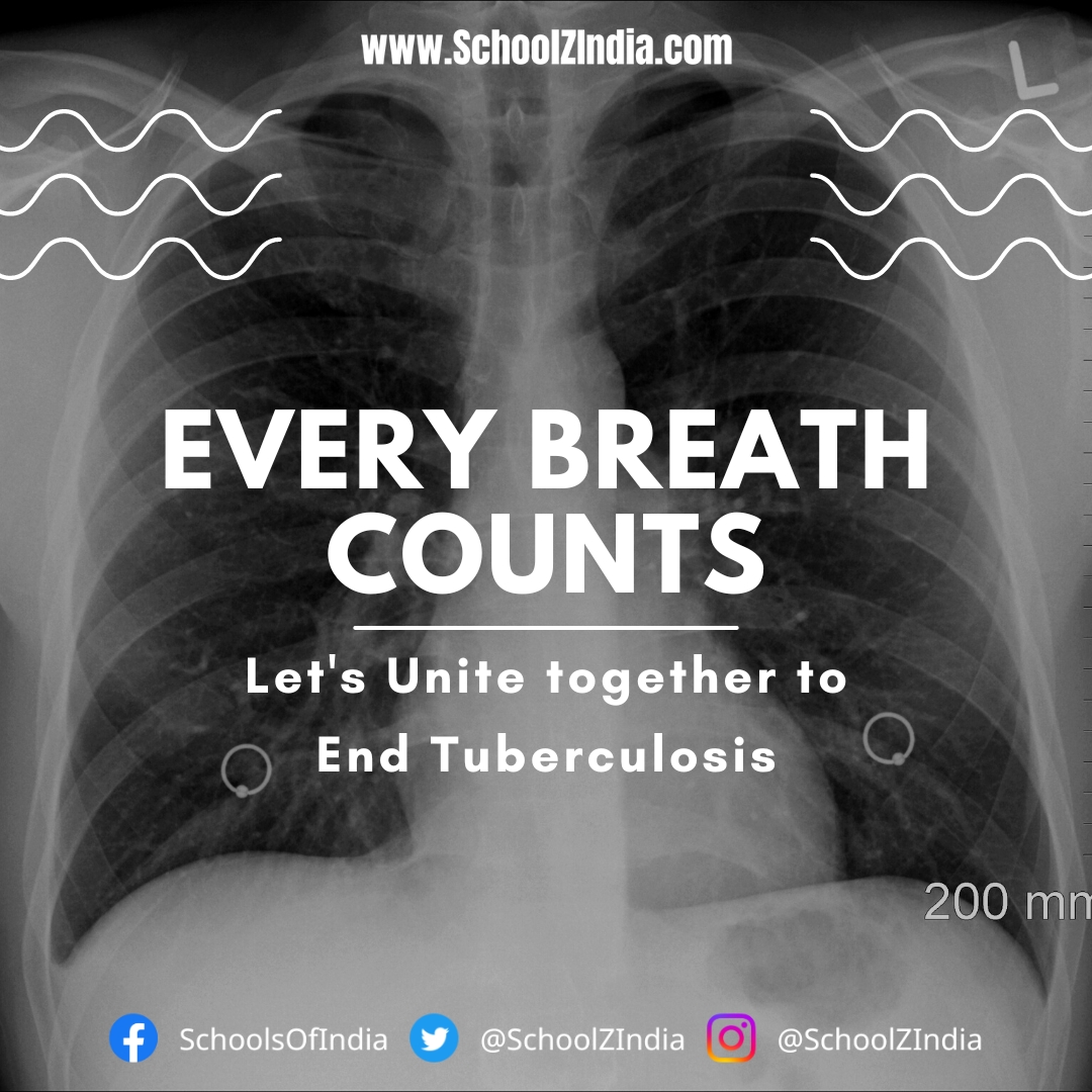 'Spread the Awareness'
#WorldTuberculosisDay #tuberculosisday #tuberculosis #EveryBreathCounts #UnitedTogether #EndTuberculosis #spreadtheawareness #SchoolZIndia #schoolzindiadotcom #SchoolsOfIndia #SchoolsInIndia #Schools #CBSESchool #ICSESchool #internationalschools