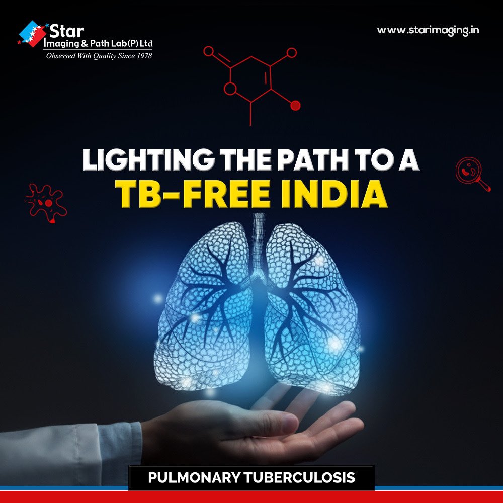 StarImaging_'s tweet photo. Join us in the fight against Pulmonary TB this World TB Day 2023! Let's shine a light on the importance of early detection and treatment with accurate TB testing at Star Imaging and Path Lab.. #WorldTBDay2023 #StopTB #StarImagingAndPathLab #PulmonaryTB https://t.co/DCTjPKdqkS