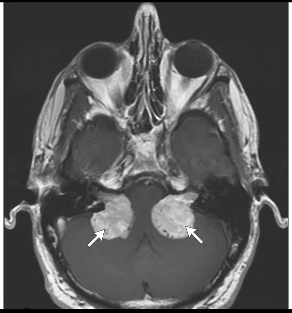 Brown Hospital Medicine on Twitter "A patient presented for evaluation