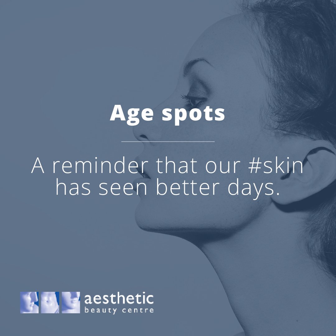 Age spots are a constant reminder that our #skin has seen better days. At #aestheticbeautycentre we offer effective treatments to remove #agespots. These include #FraxelLaserTreatment, #MicrolaserPeel, #Photorejuvenation and #TCAEasypeel.
