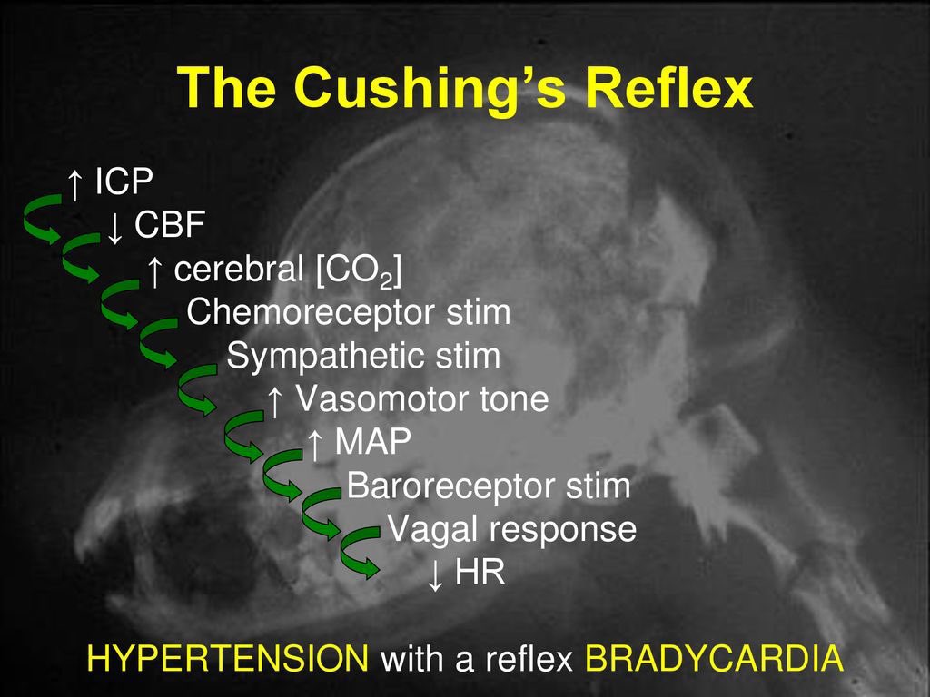 BrownJHM's tweet image. The Cushing’s reflex @EMinMiami #medtwitter
