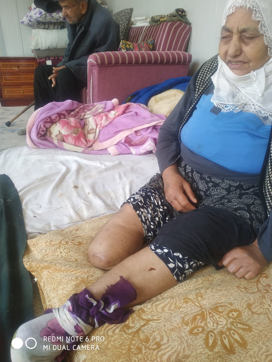 ilt_net's tweet photo. @Mugeanliatvde meraba müge abla Diyarbakır Bismil ilçesinde Ambar kuyundeyim komşum engelli akullu tekerlikli sandalye ihtiyaçları vardır şimdiden teşekkürler https://t.co/DvX4wObenO