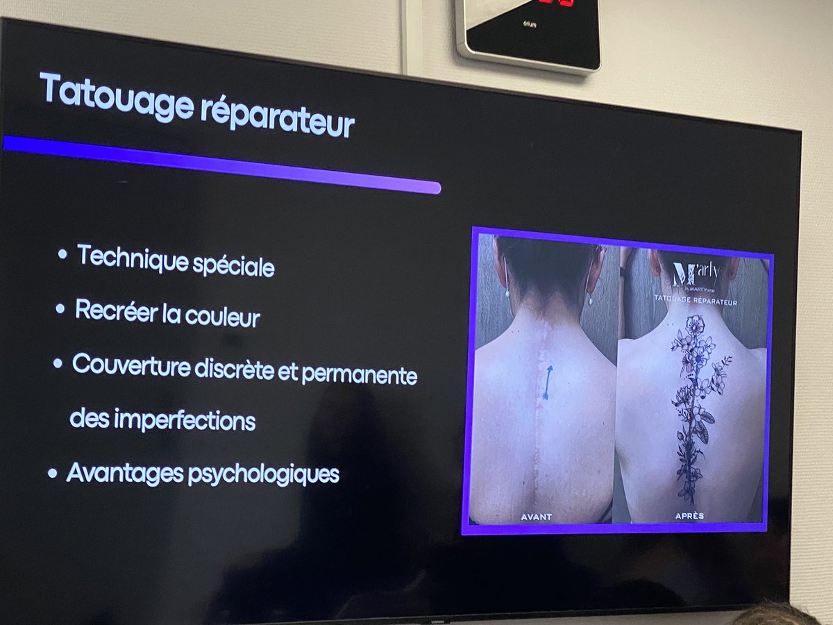Le tatouage est aussi « réparateur »