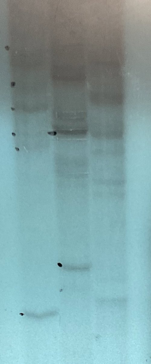 world_epidemic's tweet photo. The same date 20 yrs ago, I had an extremely lousy radiograph in a lab which did not do radioactive PAGE for ages, with half broken gel tanks etc. But this led to the discovery of #SARS-CoV RNA. 

What I want to say is: never give up hopes even your results look terrible. https://t.co/kU900r3hYe