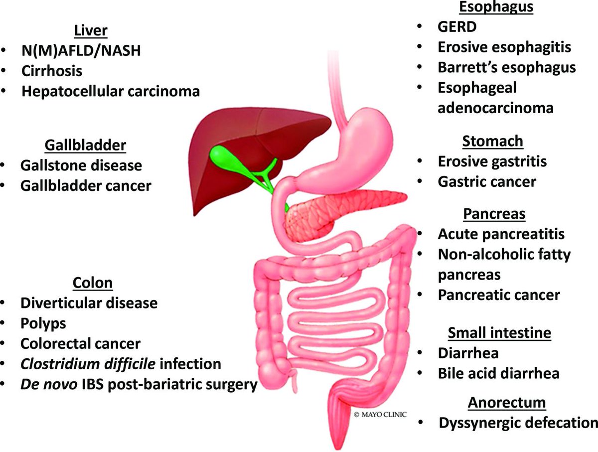 Gut_BMJ's tweet photo. Excellent #LeadingArticle by @emadelomar & Camilleri on
"Ten reasons gastroenterologists and hepatologists should be treating obesity" via https://t.co/LLpTzaW9rJ
To accompany the article in @bmj_latest "Appetite suppressant semaglutide... " via
https://t.co/ucX03DSK4s #Obesity https://t.co/Xq16ASLowx