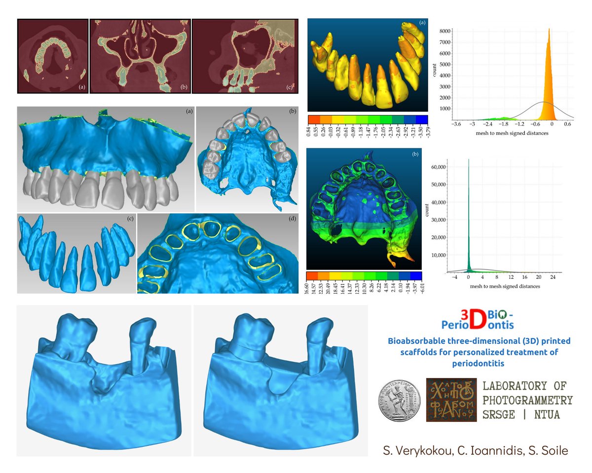 Photogrammetry Lab. of NTUA (@ntuaphotolab) on Twitter photo Our Lab. participates in the project <a href="/3dbioperio/">3D-BioPerioDontis</a> : Bioabsorbable #3D printed scaffolds for personalized treatment of #periodontitis. Prof. C. Ioannidis, <a href="/SVerykokou/">Styliani Verykokou</a> & <a href="/SofiaSoile/">SofiaSoile</a> work on #3dmodeling hard tissues of the oral cavity of patients & periodontal scaffolds. #dental Our Lab. participates in the project <a href="/3dbioperio/">3D-BioPerioDontis</a> : Bioabsorbable #3D printed scaffolds for personalized treatment of #periodontitis. Prof. C. Ioannidis, <a href="/SVerykokou/">Styliani Verykokou</a> & <a href="/SofiaSoile/">SofiaSoile</a> work on #3dmodeling hard tissues of the oral cavity of patients & periodontal scaffolds. #dental