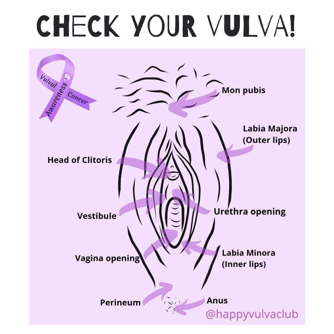 VulvalCancerUK's tweet photo. If your a nurse, midwife,Gp or work in women’s health then please take a special interest in #vulvaldisease

Here are @eveappeal and @RCObsGyn training resources for GP’s and nurses. 

https://t.co/WrwaQNe7mu

https://t.co/S9u0FKt2A4

Please also join the @bssvd_org https://t.co/VlHGQ9Tozr