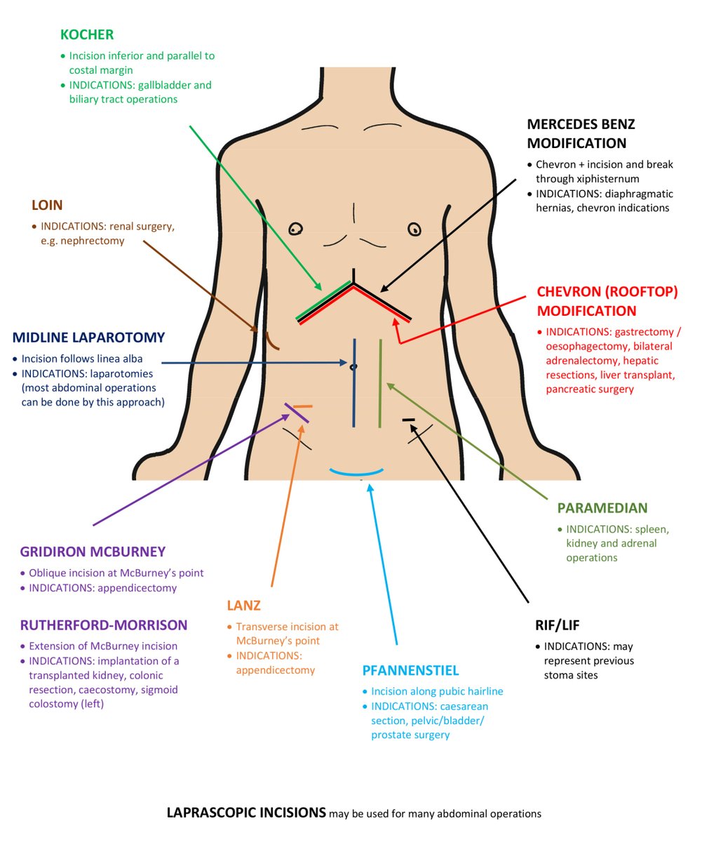 drkeithsiau's tweet photo. Abdominal surgical scars #MedEd (via @OSCEstop)

Can you offer any recommendations to revise this diagram? https://t.co/BOBclS6yuI