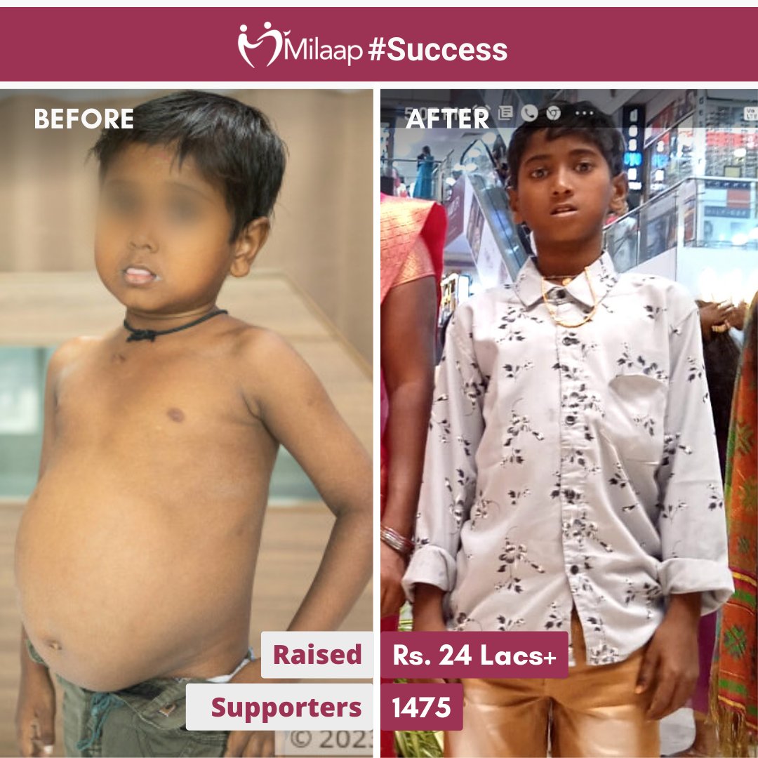 Your kind help came at the right time and more than a thousand of you contributed.

Thank you for saving another life, dear donors! We are grateful to you and so are these parents.

You make the world a better place.

#donorcommunity #savedalife #successstory #liverstransplant