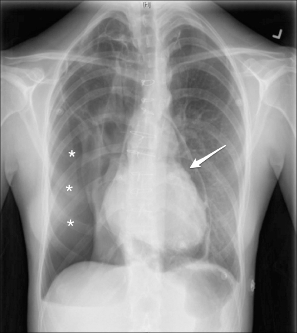 ACEP Members on Twitter "FOAMed Case "Adult Female With Dyspnea