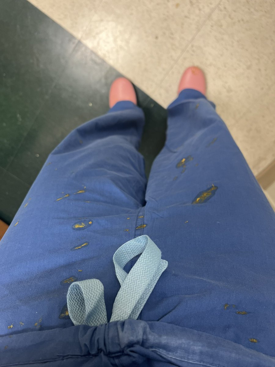 MFW_MD's tweet photo. Inspired by @kmgee9 to look at the heel of my @calzuroshoes worn PGY4-8 …. Seems like I should have looked a few *years* sooner.   I feel like I can blame @YaleSurgery #TEGS for this. Happy to report on day 1 with new shoes I got explosively stooled on by a bebé https://t.co/EDyRdon6o8