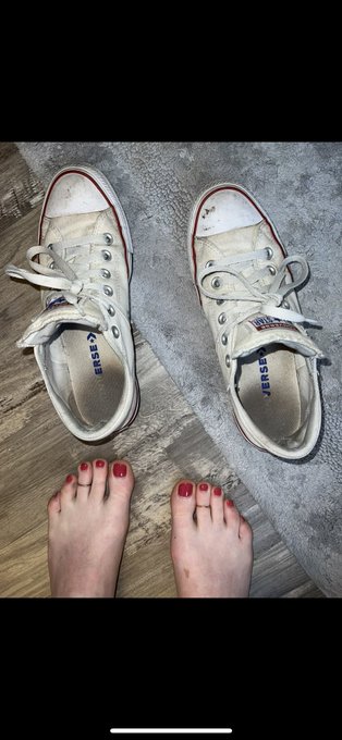 freckled_feet